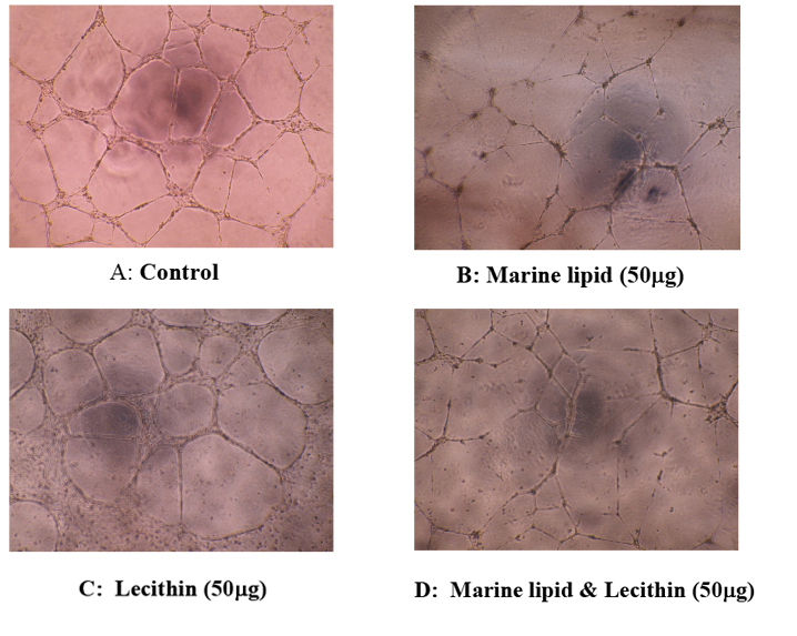 Synergistic effect on anti-angiogenesis by a mixture of marine lipid with lecithin In vitro angiogenesis tube formation assay